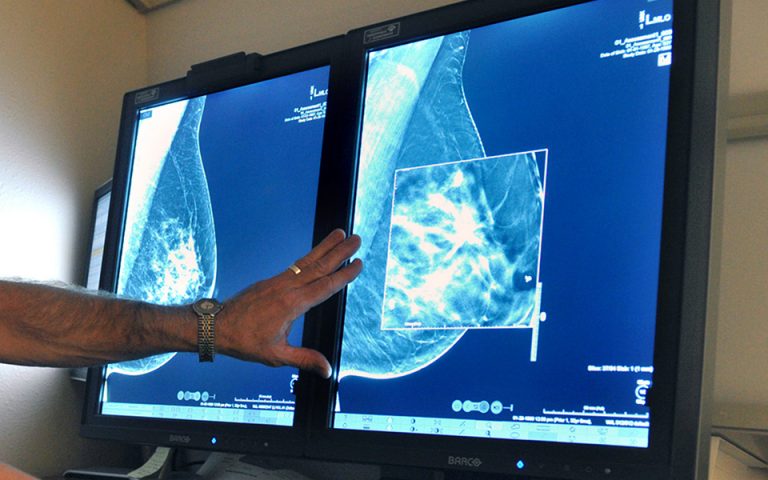 Η εξωσωματική μπορεί να προκαλέσει καρκίνο του μαστού