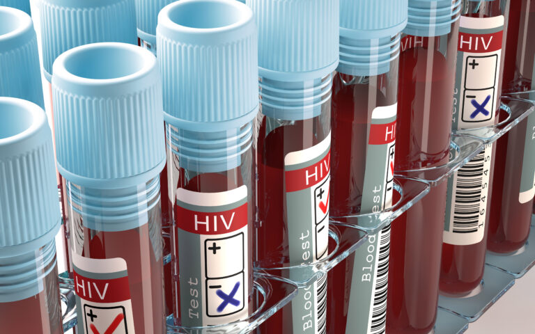 Ενθαρρυντικά αποτελέσματα από δοκιμές πειραματικού mRNA εμβολίου κατά του HIV