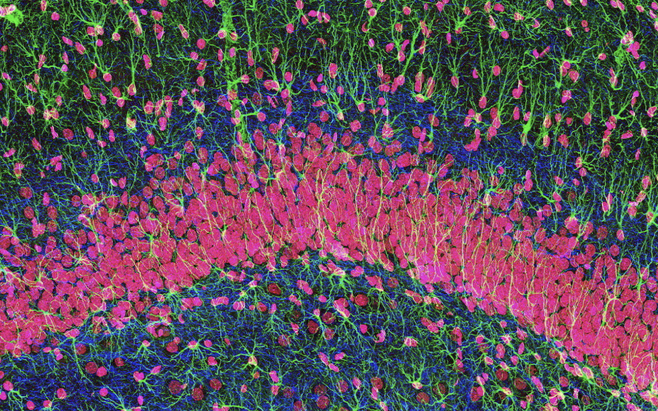 Τα «τρανζίστορ» του μυαλού: Οι νευρώνες δεν είναι τα μόνα εγκεφαλικά κύτταρα που σκέφτονται-4