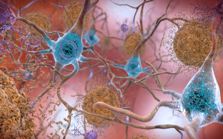 Τα «τρανζίστορ» του μυαλού: Οι νευρώνες δεν είναι τα μόνα εγκεφαλικά κύτταρα που σκέφτονται