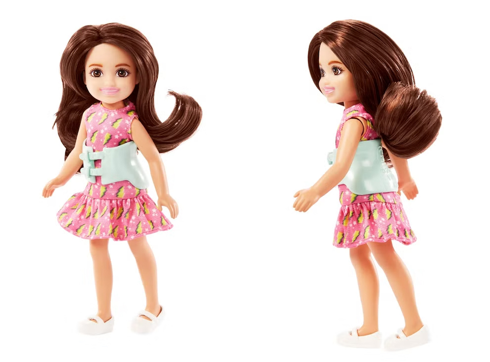 Η μικρή αδελφή της Barbie έχει σκολίωση: Η πρώτη κούκλα που φορά κηδεμόνα-1