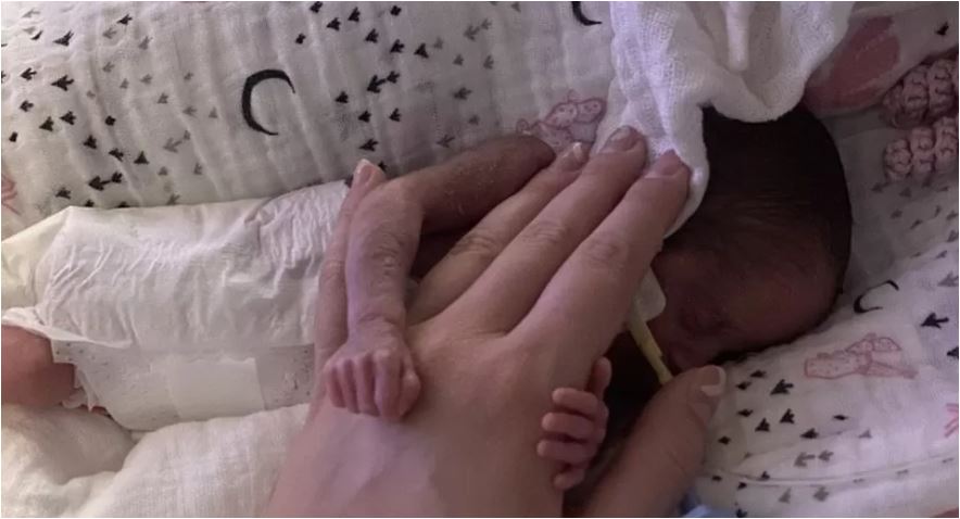 Γεννήθηκε 22 εβδομάδων και 515 γραμμάρια κι έζησε κόντρα στις πιθανότητες-1