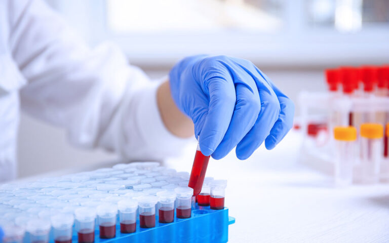 NHS: Πολλά υποσχόμενη εξέταση αίματος για τον εντοπισμό δεκάδων τύπων καρκίνου