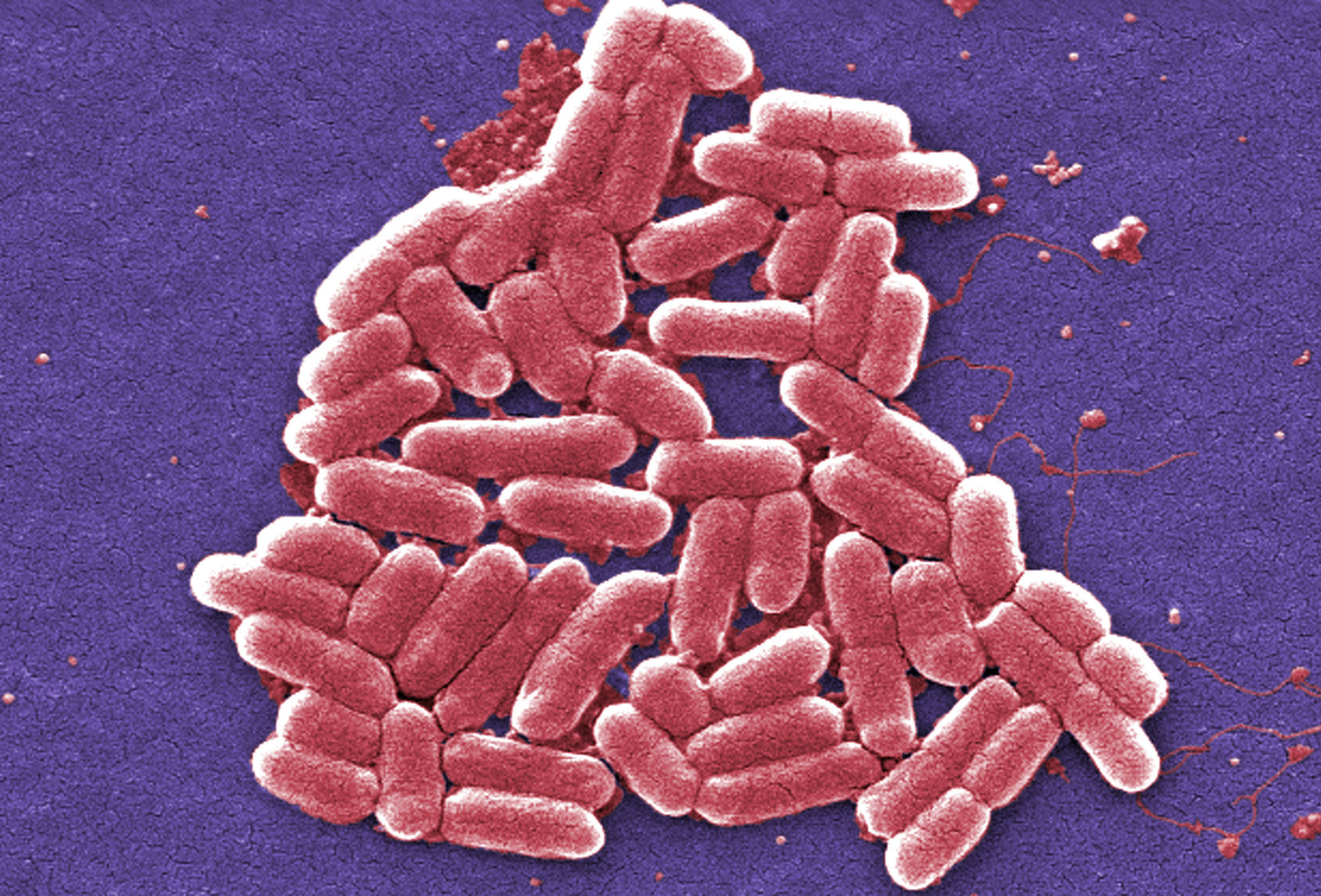 Τα υπερμικρόβια: Η «αθόρυβη πανδημία» που σκοτώνει εκατομμύρια ανθρώπους κάθε χρόνο-1