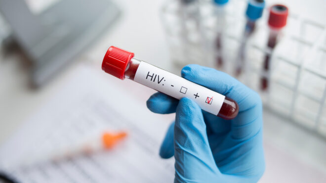 aids-αυξήθηκαν-οι-μολύνσεις-hiv-στην-ελλάδα-562759468