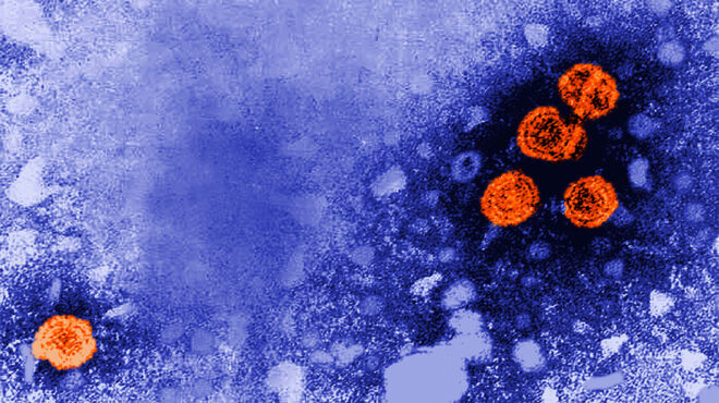 που-οι-ιοί-της-ηπατίτιδας-προκαλούν-ακ-562972627
